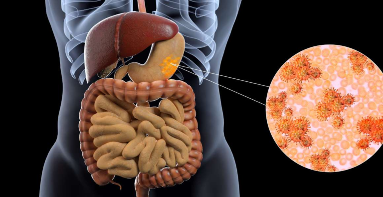Çfarë e bllokon përthithjen e magnezit?